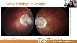 Lecture Glaucoma in the Myopic Eye [upl. by Idahs678]