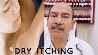 DRY ITCHING  Symptoms causes prevention and homeopathic treatment  Dr RSVerma [upl. by Ahsirahc]