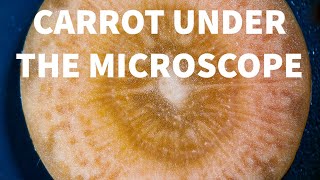 CARROT under a stereoscopic microscope [upl. by Bridget]