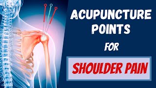 Acupuncture Points for Shoulder Pain [upl. by Roderick]