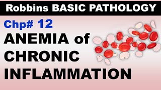 Ch12  Anemia of Chronic Inflammation  Blood Pathology  Dr Asif Lectures [upl. by Penland]