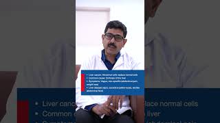 What is Liver Cancer Causes Symptoms amp Treatment [upl. by Rudd]