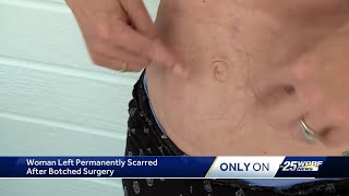 Victim of botched cosmetic surgery in Port St Lucie urging others to come forward [upl. by Aerua]