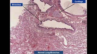 Pathology Conference  Dr Sigdel Part 1 [upl. by Ojeillib701]