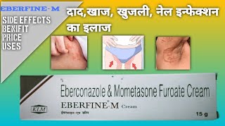 Eberfine m cream price eberfine m cream uses eberfine min hindi एबरफिन एम क्रीम eberfine m fungal [upl. by Yanat]