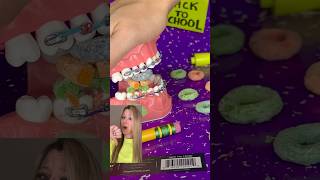 WORST HABITS FOR BRACES 🫣 Bad Habits for your Teeth 🦷 Orthodontist Reacts Crunchy RAMEN Food ASMR [upl. by Peedsaj]