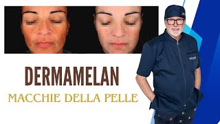 DERMAMELAN addio alle macchie della pelle [upl. by Eynahpets741]