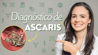 Diagnóstico de Ascaris lumbricoides [upl. by Thornburg]