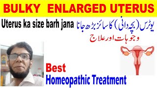 bulky uterus treatment in urdu hindiBacha dani ka size badrhnabulky uterus ka ilaj homeopathic [upl. by Gerius]