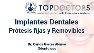 Implantes Dentales Prótesis fijas y Removibles [upl. by Areema506]