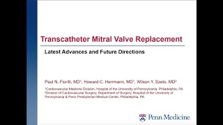 Transcatheter mitral valve replacement latest advances and future directions [upl. by Aivart]