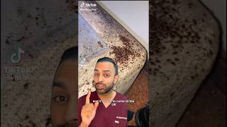 How To Get Rid Of Bed Bugs  Fast Dr Somji Explains [upl. by Selrahc]