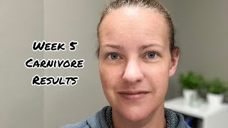 Carnivore Diet Week 5 Results [upl. by Eisenberg16]