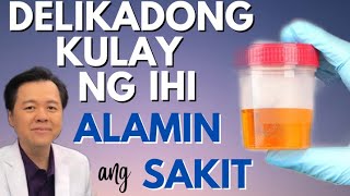 Delikadong Kulay ng Ihi  Alamin ang Sakit  By Doc Willie Ong Internist and Cardiologist [upl. by Edyaw]