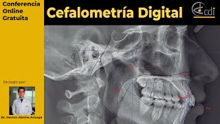 Curso Cefalometría Digital [upl. by Lebbie]