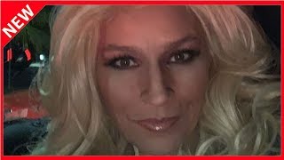 Nach KrebsRückfall Beth Chapman wieder im Krankenhaus [upl. by Atinahc86]