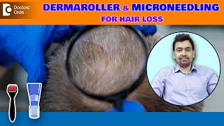 AT HOME Microneedling amp Dermaroller for HAIR LOSS Explained by  DrRajdeep Mysore Doctors Circle [upl. by Shanley]