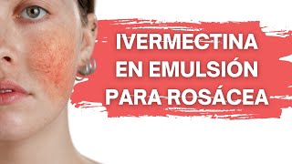 Emulsión con ivermectina para rosácea [upl. by Burnaby]