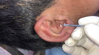 Ear Blackhead Removal  Blackheads in Ear 2024 [upl. by Atteroc]