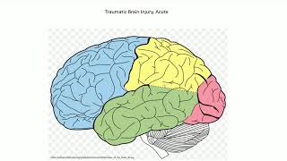 Acute Traumatic Brain Injury  Adventures in Neuropathology [upl. by Amitaf949]