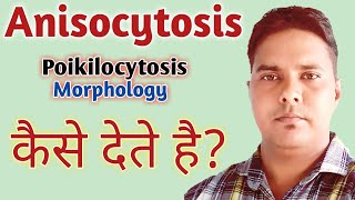 Anisocytosis in hindi  Poikilocytosis in hindi  Anisopoikilocytosis in hindi  RBC morphology [upl. by Nelac116]