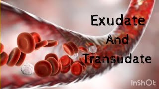 Exudate and Transudate  Basic Pathology [upl. by Rudd]