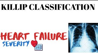 Killip Classification  Heart failure  cardiovascular system  medinject [upl. by Eanil]