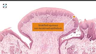 Histology of tongue  Circumvallate papilla [upl. by Tesler]