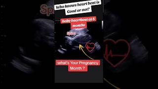 6 months baby heartbeat in pregnancy ultrasound 🥰🥰viralvideo trending viralshorts [upl. by Itsirc617]