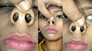 Piggy nose and nose hair cuttingpignose pammibeautyworldpummybeautyworld juthikasmakeover [upl. by Orozco806]