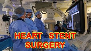 Heart Stent Surgery [upl. by Calesta]