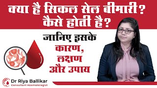 क्या होती है सिकल सेल बीमारी  What is Sickle Cell Disease  Causes Symptomps and Treatment [upl. by Sonny]