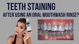 TeethStaining After Using Chlorhexidine Gluconate Mouthwash  Can the oral rinse stain teeth [upl. by Lotta]