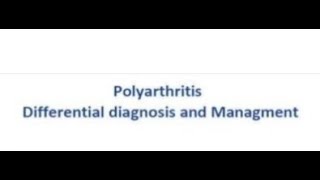 Rheumatolgy  polyarthritis [upl. by Margie]