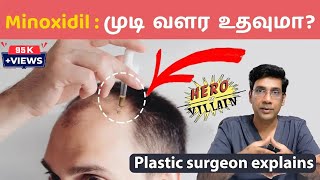 முடி வளர்ச்சிக்கு மினாக்ஸிடில் எப்படி பயன்படுத்துவது Minoxidil  Hair Loss clinic coimbatore [upl. by Dylan]