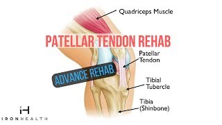 Patellar Tendon Rehab ADVANCE REHAB  Iron Health [upl. by Panaggio58]