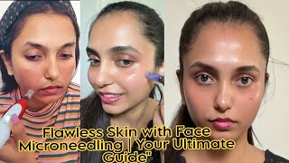 Flawless Skin with Face Microneedling Your Ultimate MICRONEEDLING AT HOMEskincareskinrejuvenation [upl. by Horton]