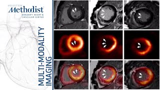 Heart Failure 1 Evaluating Myocardial ViabilityRole of MMI Zoghbi AlMallah Shah Jan 14 2020 [upl. by Carlen990]