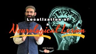 Localization of a Neurological Lesion Part I  Introduction [upl. by Isaak]