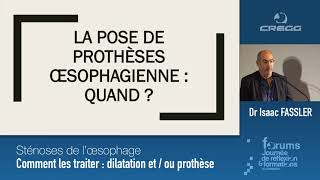 Dr FASSLER  Sténoses de l’oesophage  comment les traiter dilatation etou prothèse [upl. by Vachell]