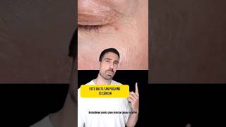 ⚠️ Cómo detectar CÁNCER en la PIEL‼️ Dermatólogo cuenta como cuidar la piel de la cara y el cutis [upl. by Akisej209]