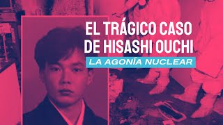 El trágico caso de Hisashi Ouchi La agonía nuclear [upl. by Aneetsirk]