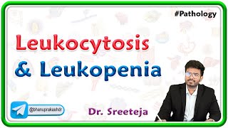 18 Leukocytosis and Leukopenia  USMLE Step 1 Pathology [upl. by Cathryn]