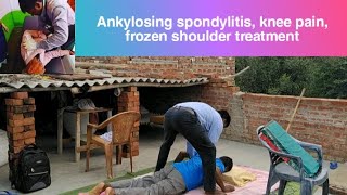 ankylosing spondylitis treatment  Neurotherapy  chiropractic treatment by Abdhesh Kumar Delhi [upl. by Ahsercal]