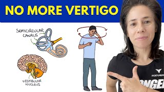 The 1 CAUSE Behind Vertigo [upl. by Tomlinson]