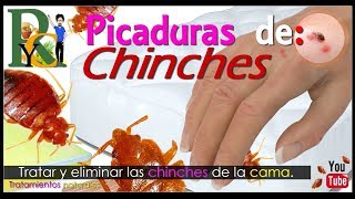 🕷️🐛 Picaduras de chinches  Piquetes de chinches  Como eliminar chinches de la cama picaduras 🛏️ [upl. by Wolford]