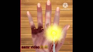 ASMR video finger treatment 😆😆 [upl. by Jovia]