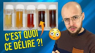 Que cache la COULEUR de votre URINE [upl. by Oicnevuj]