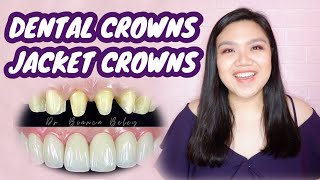 DENTAL CROWNS or JACKET CROWNS 🦷👑  Pinoy Dentist Explained  Dr Bianca Beley [upl. by Weathers]