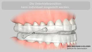 Schnarchschiene Köln  Funktion einer AntiSchnarchschiene [upl. by Birdt474]